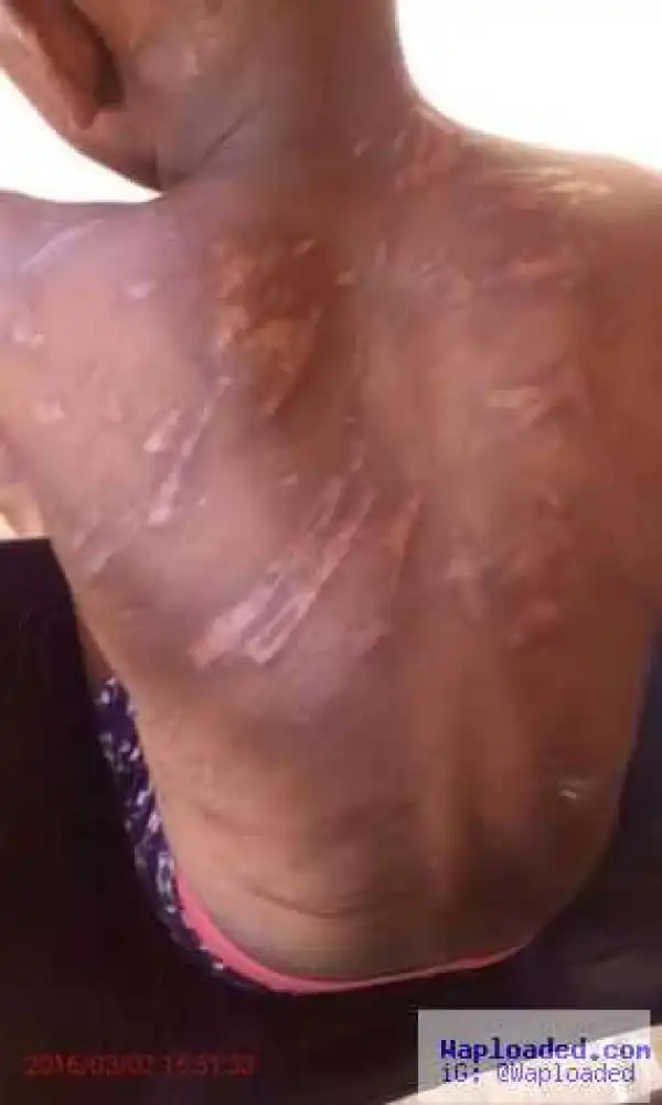 Photos: Father brutally beats 8yr old son, leaving with a fractured hand & leg